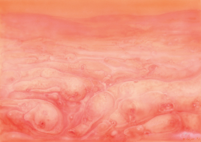 Landscape XXII