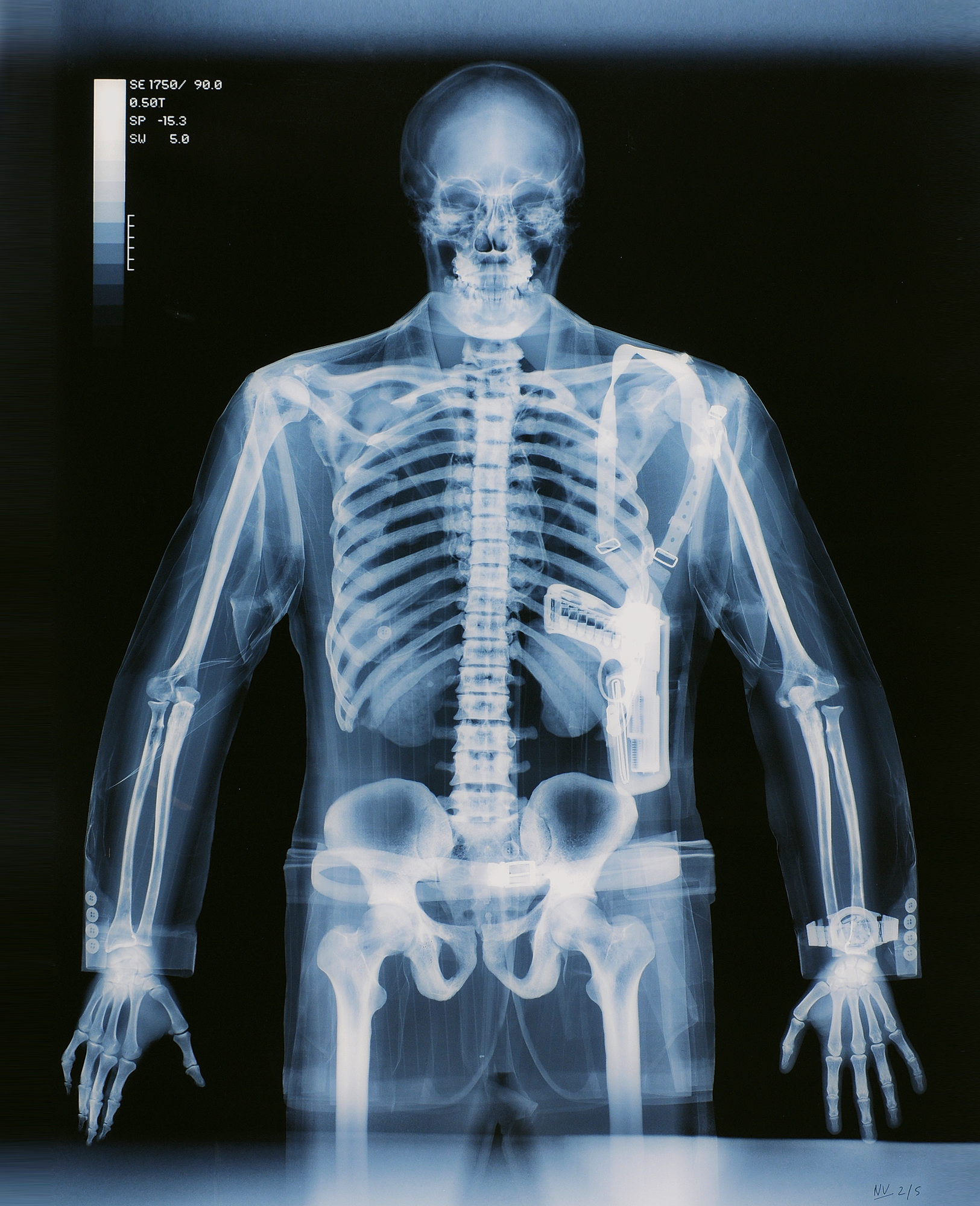 Nick Veasey, Gunman