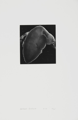 2 photographs: Hand, 1991; Snail