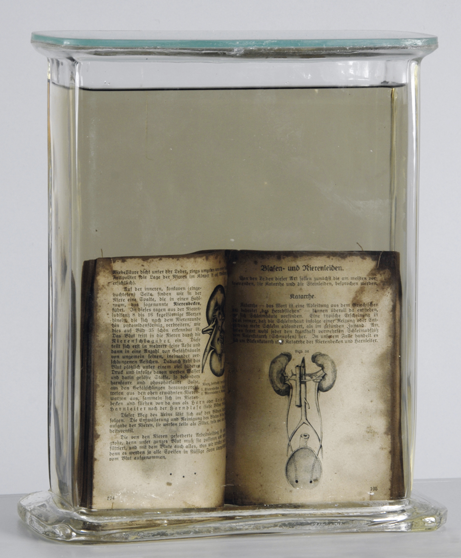 Roman Ondák, From the cycle "Ludské problémy (Human Problems)"