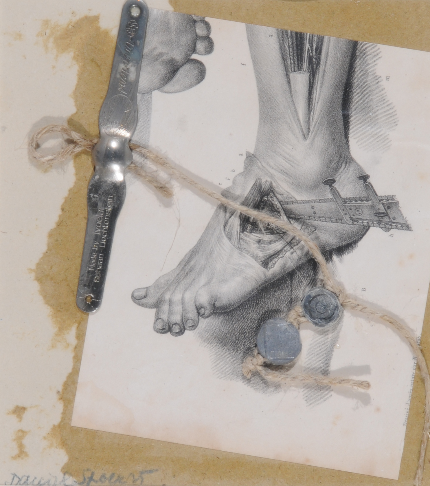 Daniel Spoerri, La médicine opératoire dessinée d'après nature par N. H. Jacob (1839)