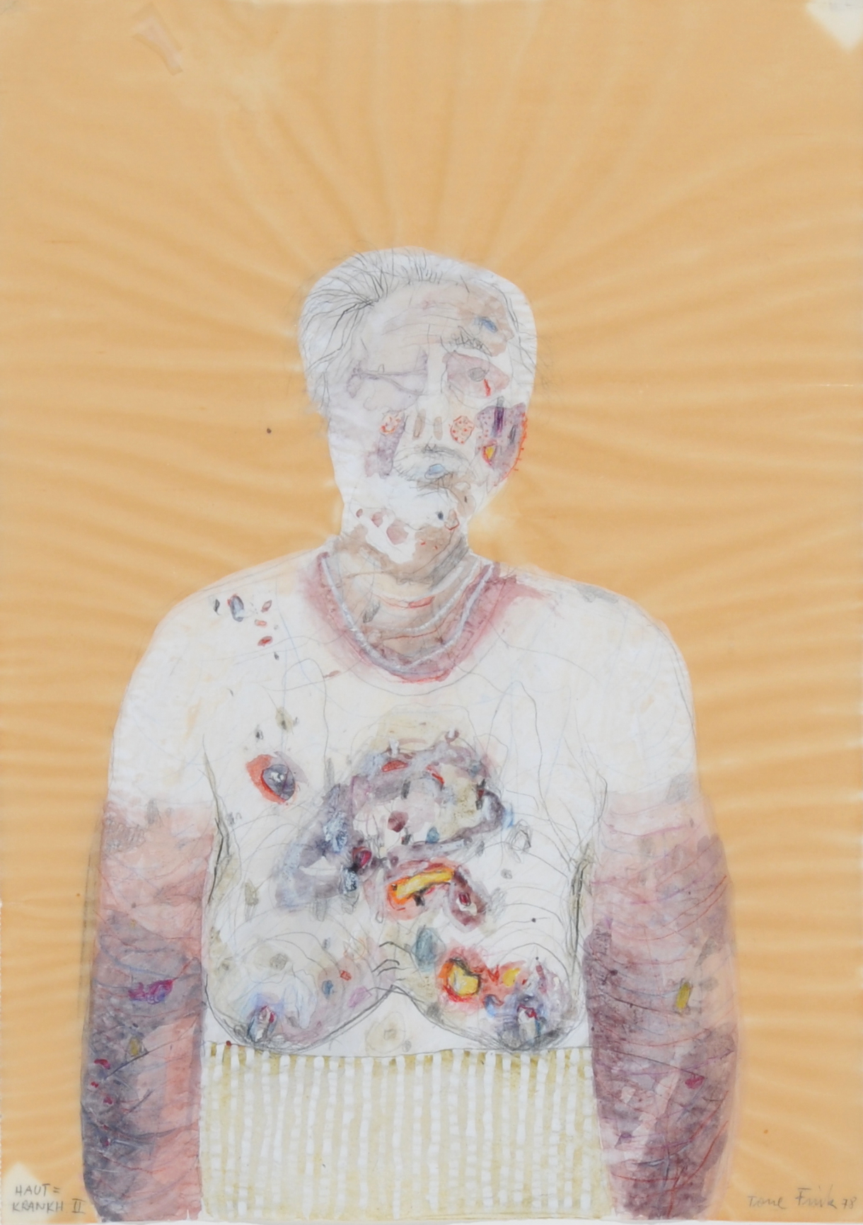 Tone (Anton) Fink, Hautkrankh. II