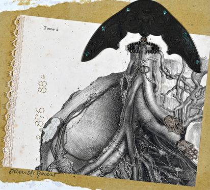 Collage from series "La médicine opératoire dessinée d'après nature par N.H. Jacob"
