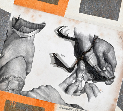 Collage from series "La médicine opératoire dessinée d'après nature par N.H. Jacob"